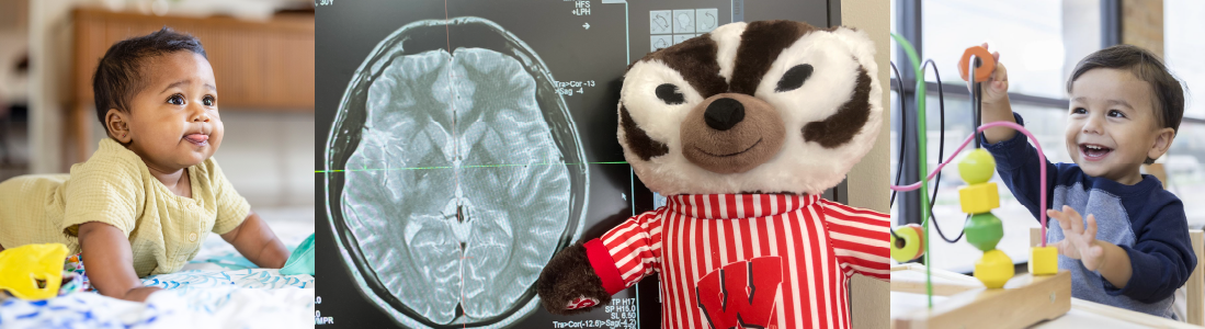 Collage of baby, child and stuffed Bucky Badger next to a brain scan.